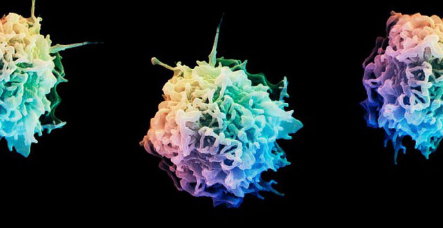 Celulas T cancer